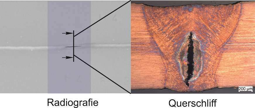 Bildbeschreibung: Die Abbildung zeigt ein Röntgenbild einer rissbehafteten Laserstrahlschweißnaht und einen an der Rissstelle entnommenen Querschliff der Naht. Im Querschliff ist der Erstarrungsriss in der Schweißnaht zu sehen.